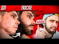 Лучший Способ Отрастить МУЖИЦКУЮ БОРОДУ! МИНОКСИДИЛ (minoxidil)