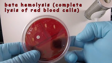 Streptococcus pyogenes on Blood Agar with a Taxo A Disc