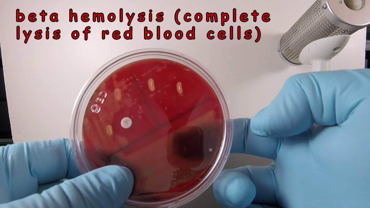 Streptococcus pyogenes on Blood Agar with a Taxo A Disc