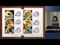 2-D Vs. 3-D TTE for Tricuspid Valve Anatomy