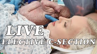 Scheduled C Section Birth Vlog Bringing Newborn Baby Home First 24 Hours With A Newborn
