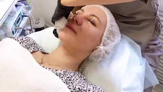 Процедура BIOLINE Proceutic - Видео от Star Beauty Service