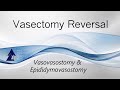 Vasectomy Reversal - How It&#39;s Performed, Including Vasovasostomy and Epididymovasostomy