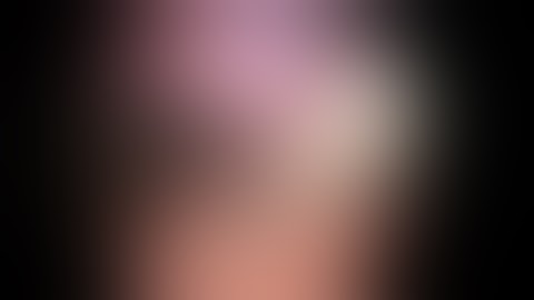 Laparoscopic Transgastric Submucosal Mass Resection