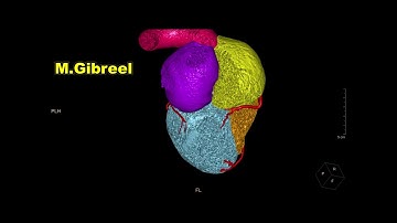 Within normal MSCT coronary angiography ,,,Heart segmentation,,,