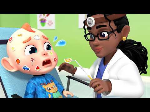 Ouchie! Baby Has Sticker Pox | Doctor Song for Kids | Rosoo Nursery Rhymes
