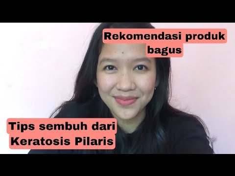 Video: 4 Cara Merawat Lepuh pada Kaki