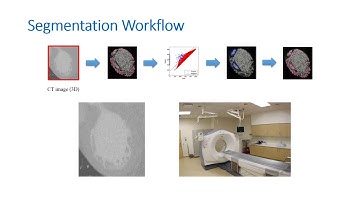 Cardiac Trabeculae Segmentation: an Application of Computational Topology (SOCG 17 MM Final)