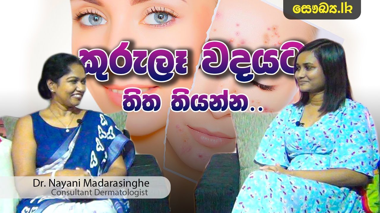 ඔබේ මුහුනේ කුරුලෑ පිලිබදව සිතන්නට යමක් | Consultant Dermatologist Dr. Nayani Madarasinghe