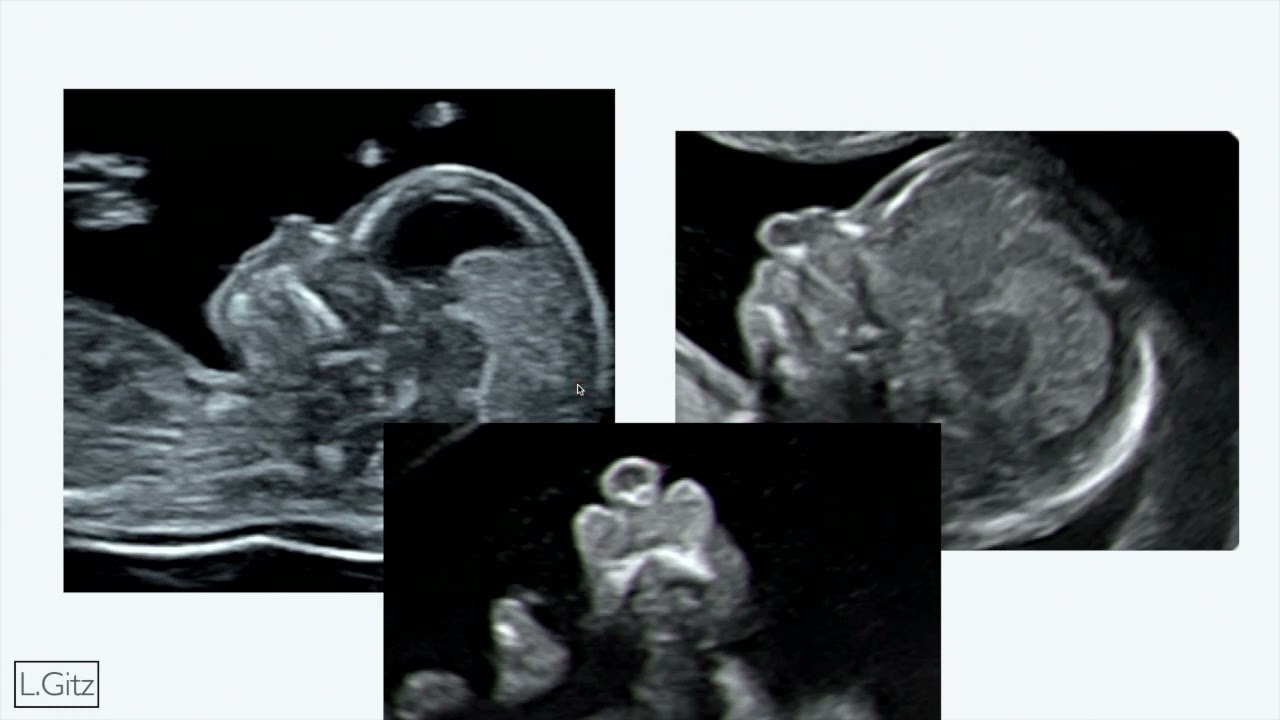 Les anomalies à ne pas louper au 1er trimestre