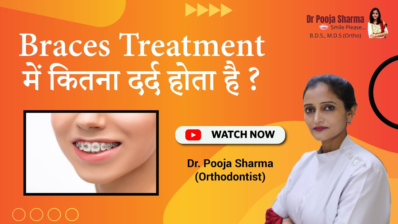 Is Braces Treatment Extremely Painful? Best Braces Treatment in Agra, India Dr. Pooja Sharma