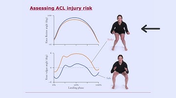 Biomechanics of Movement | Lecture 7.1: Why Quantify Movement?