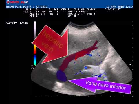 arterialized portal vein flow