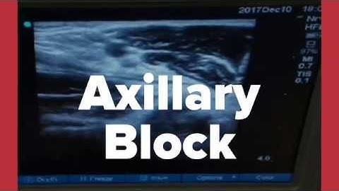 Axillary Block