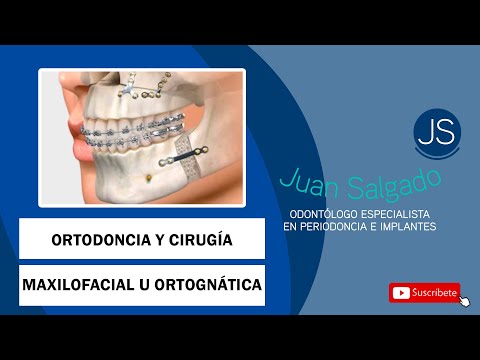 Ortodoncia y cirugía maxilofacial u ortognática / Odontologia Practica