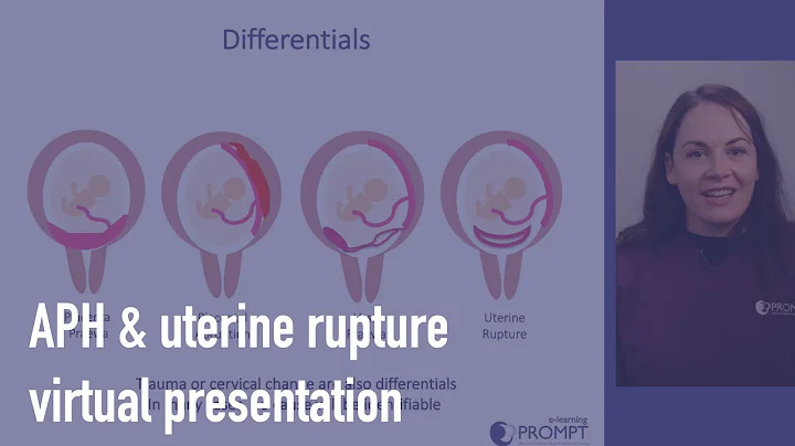 Antepartum haemorrhage & uterine rupture - DayDayNews