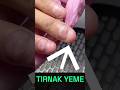 Tırnak Yeme Alışkanlığının KORKUNÇ Sonuçları
