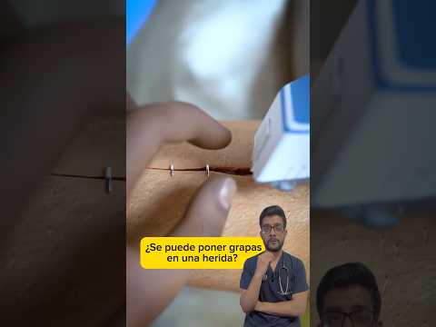 🎬 Video relacionado con quitagrapas