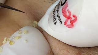 Satisfying Relaxing #ThuyTruong576