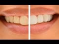 How to Whiten Teeth in Photoshop! TWO STEPS!!