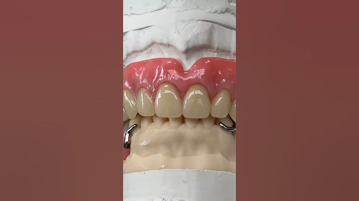 Upper Wax and Lower Metal Try-In @EnvisiontecMain #dental #teeth #smile #lsk121shorts #envisiontec