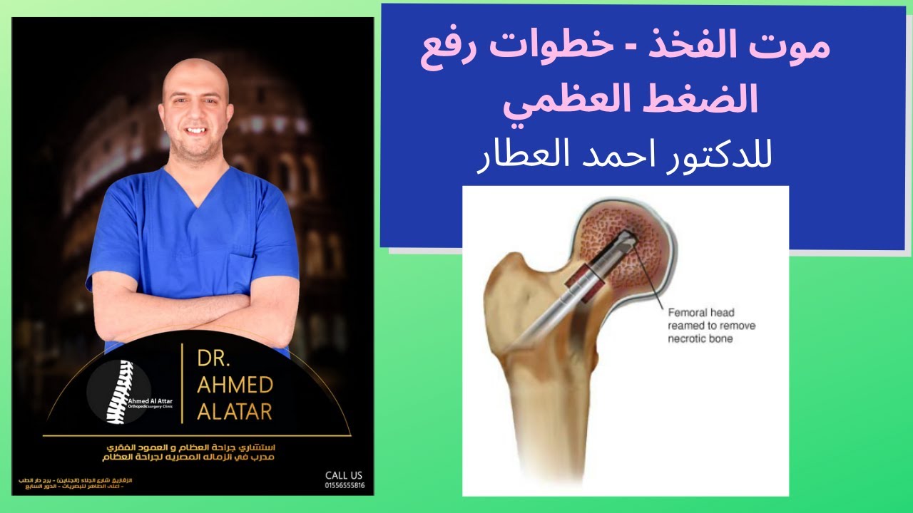 موت الفخذ - خطوات رفع الضغط العظمي