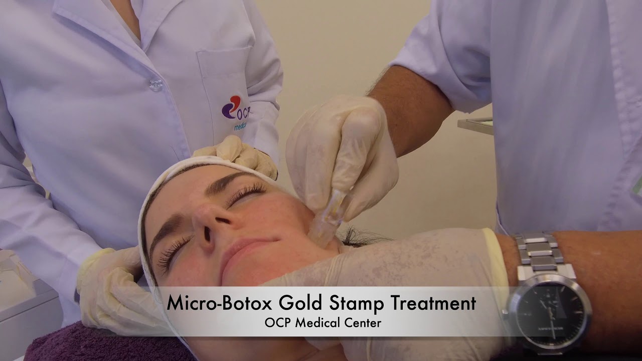 MicroBotox Gold Stamping Treatment OCP Medical Center Dubai YouTube