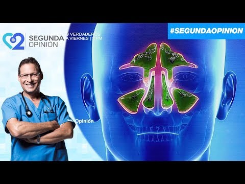 Vídeo: Sinusitis En Adultos: Causas, Signos Y Síntomas De La Sinusitis. ¿Puedo Calentarme La Nariz?