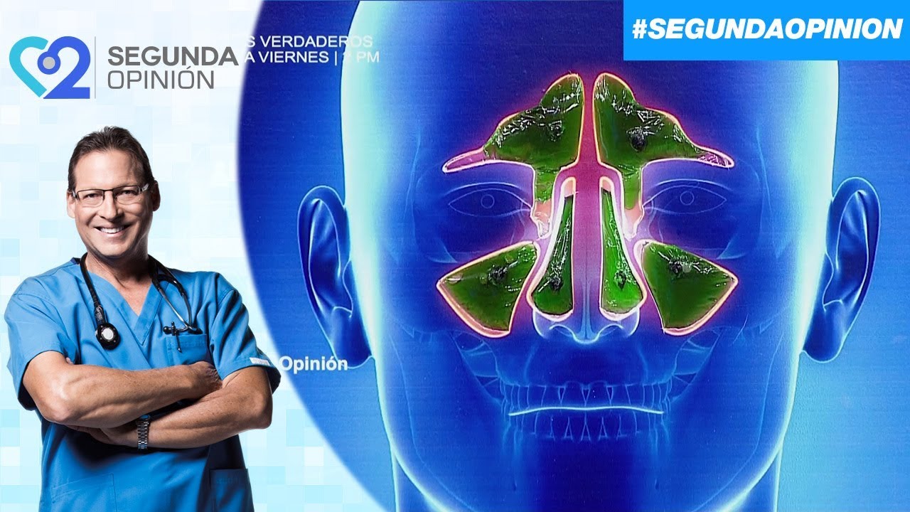 que es la sinusitis y cuales son sus sintomas