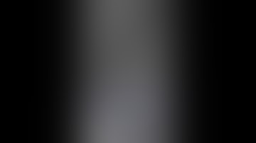 ERCP: wire guided cannulation (N loop)