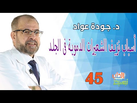 فيديو: هل النزف النقطي و الفرفرية هما نفس الشيء؟