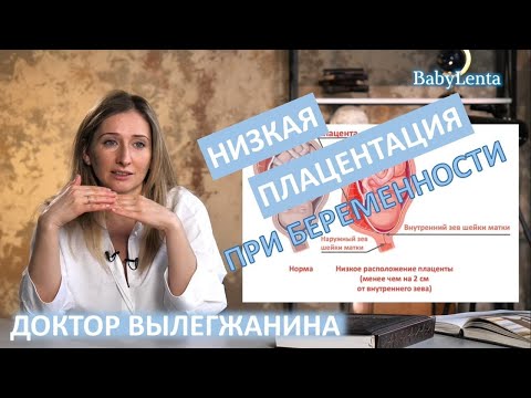 Низкая плацентация при беременности - что это такое, причины, опасность, что делать!