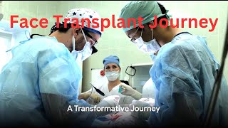 The Transformation: Katie Stubblefield's Face Transplant Journey