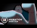 TRICHOTILLOMANIA! | A Google Search goes Wrong in this Animated Short Film