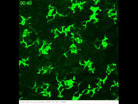 Video: Adakah sel langerhans antigen menunjukkan sel?