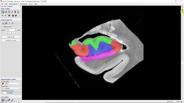 Hippocampal subfield anatomy