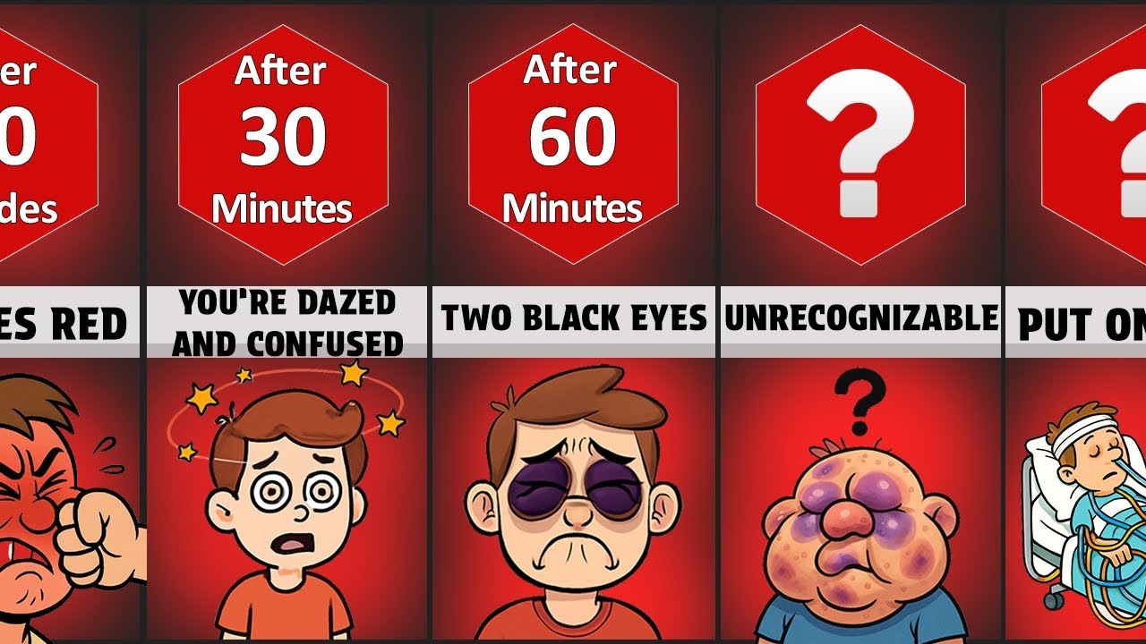 Timeline: What Would Happen If You Kept Getting Punched ?