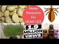Top 5 home remedies to get rid of head lice  nits  sushmitas diaries