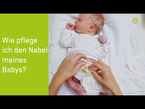 Video: Kann man ein Baby mit einem Nabelschnurgranulom baden?