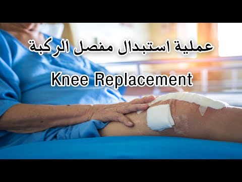 عملية استبدال مفصل الركبة |  Knee replacement