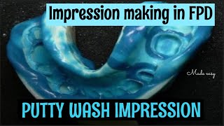 PUTTY WASH IMPRESSION || FIXED PARTIAL DENTURE IMPRESSION TECHNIQUE || FPD