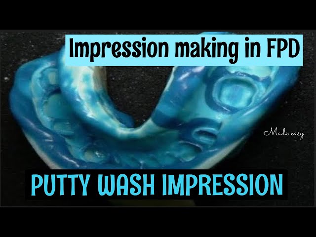 PUTTY WASH IMPRESSION || FIXED PARTIAL DENTURE IMPRESSION TECHNIQUE || FPD class=