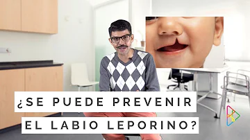 ¿Cómo puedo prevenir el labio leporino durante el embarazo?