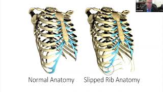 Slipping Rib Syndrome, Functional Lower Rib Disorders, and Abominal Vascular Compression Syndromes