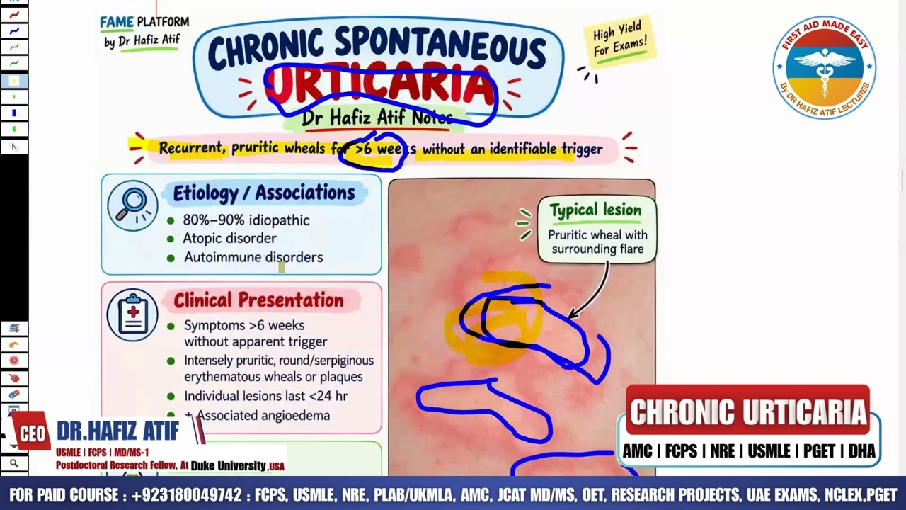 CHRONIC URTICARIA | Rapid Revision | High-Yield Topic for AMC | Dr Hafiz Atif
