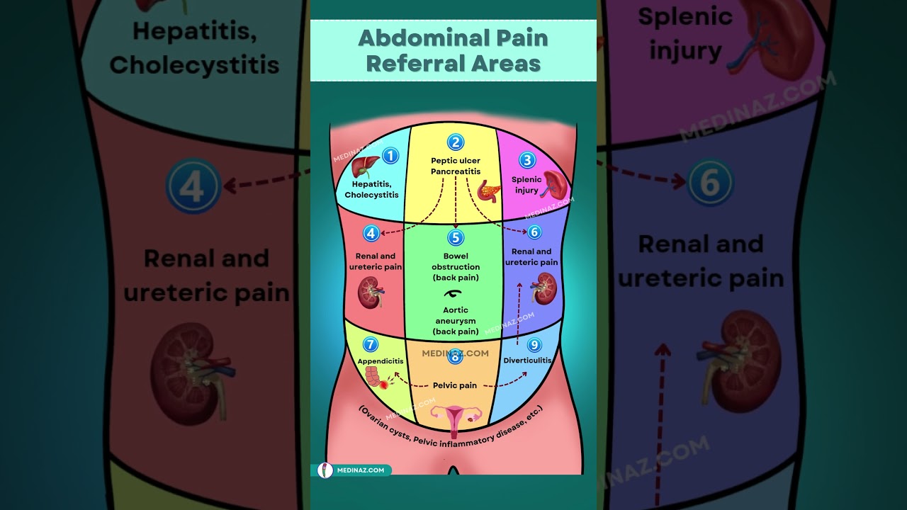 Abdominal Pain Referral Areas You Need to Know About NOW