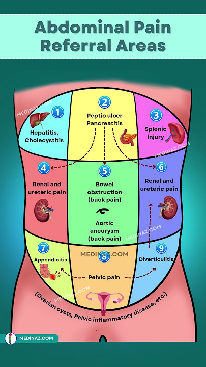 Abdominal Pain Referral Areas You Need to Know About NOW