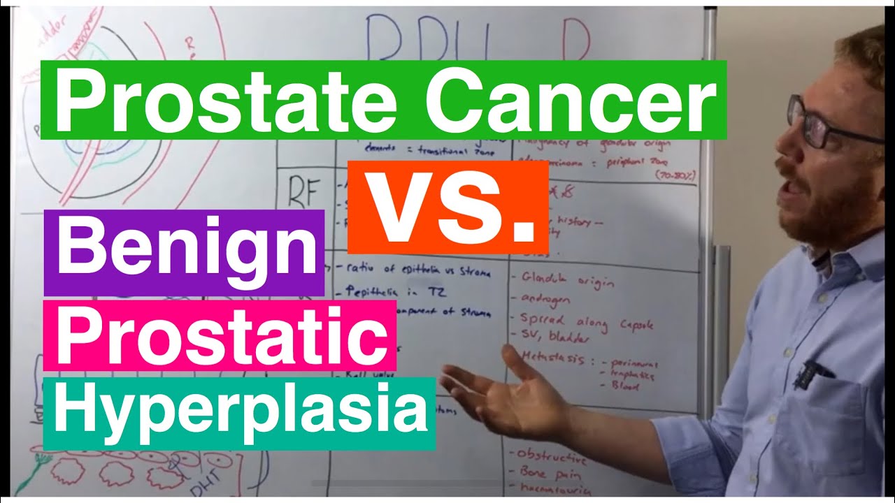 bph vs prostate cancer symptoms