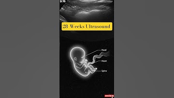 28 Weeks Pregnancy Ultrasound | Baby Head, Heart & Spine