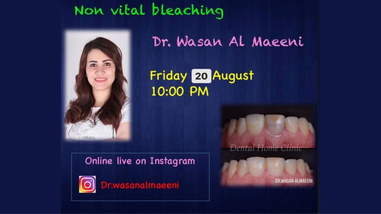 🔴 لايف الدكتوره وسن رشيد عن Non Vital Bleaching
